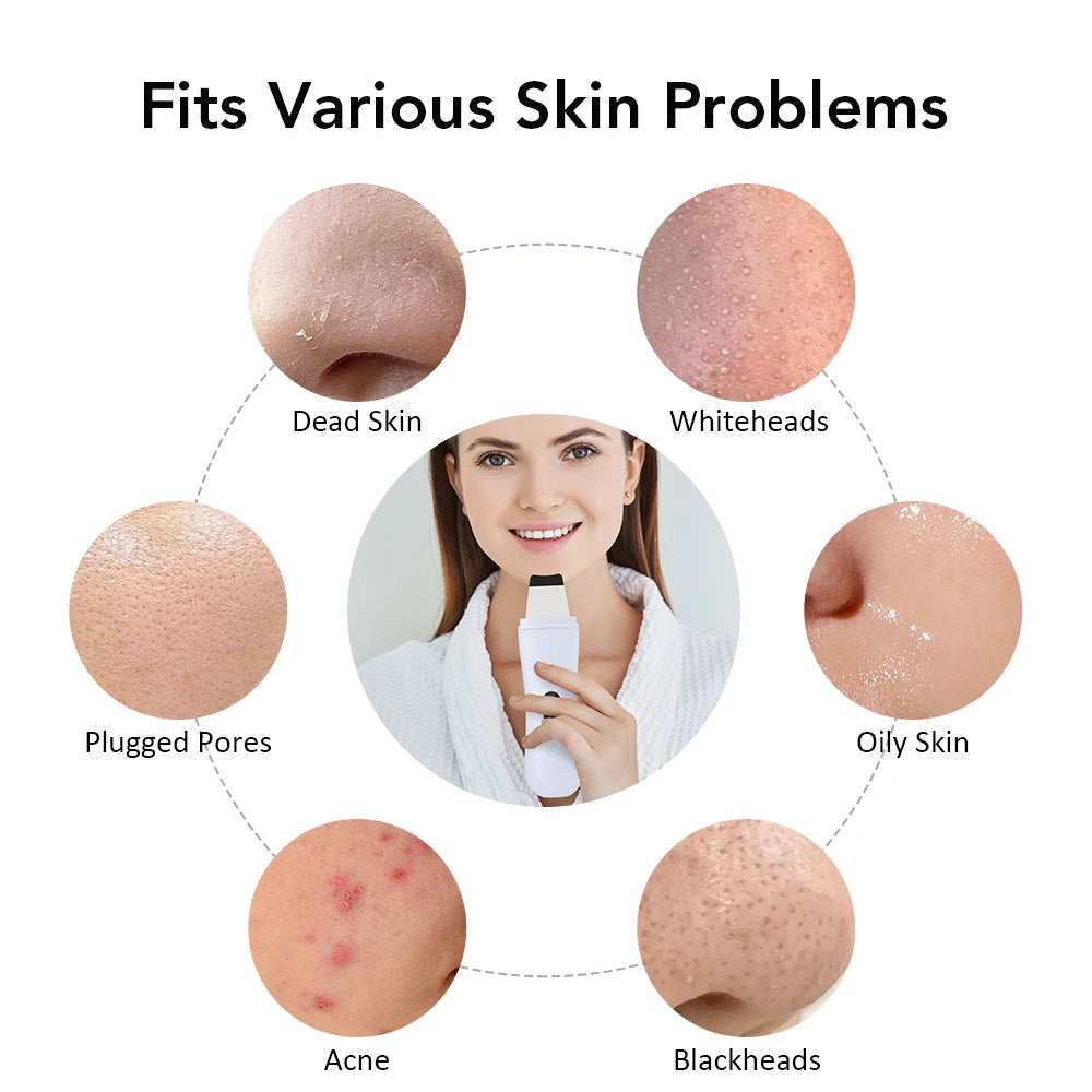Nettoyeur de pores électrique – Outil professionnel de soins de la peau