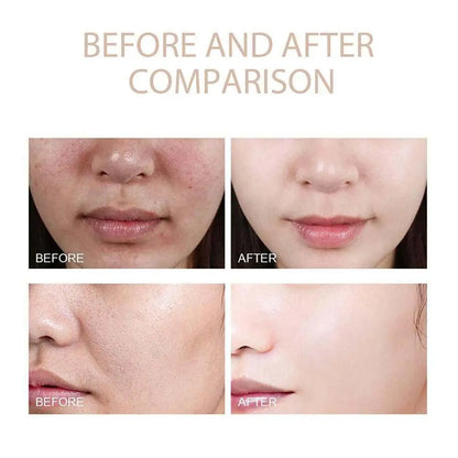 Sérum exfoliant Dr. Melaxin Rice