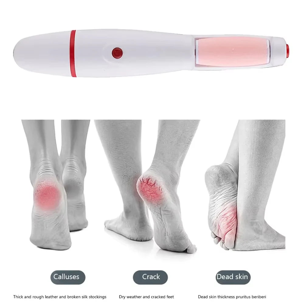 Appareil Électrique Anti-callosités / Râpe Pieds Rechargeable