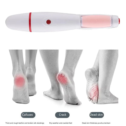 Appareil Électrique Anti-callosités / Râpe Pieds Rechargeable