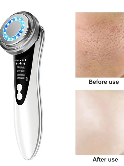 Appareil de Beauté Ultrason & LED – Anti-Âge & Soin Visage Professionnel