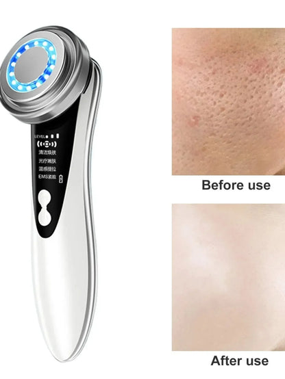 Appareil de Beauté Ultrason & LED – Anti-Âge & Soin Visage Professionnel